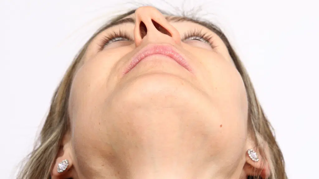 Can a Deviated Septum Cause Sleep Apnea?
