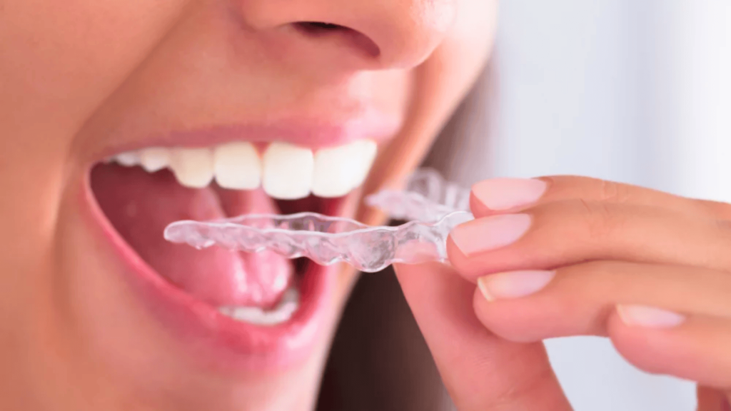 mouth-night-guard-jaw-pain