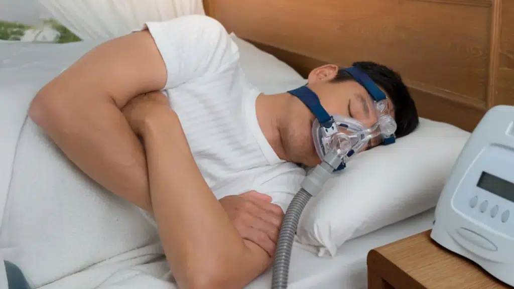 sleep apnnea va rating