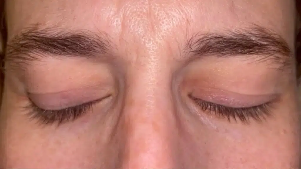 what is rapid eye movemnt