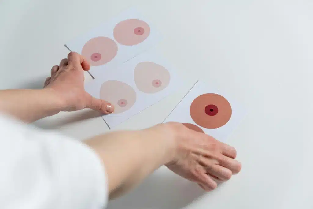 Types of Breast Implants: Which Option Is Right for You?