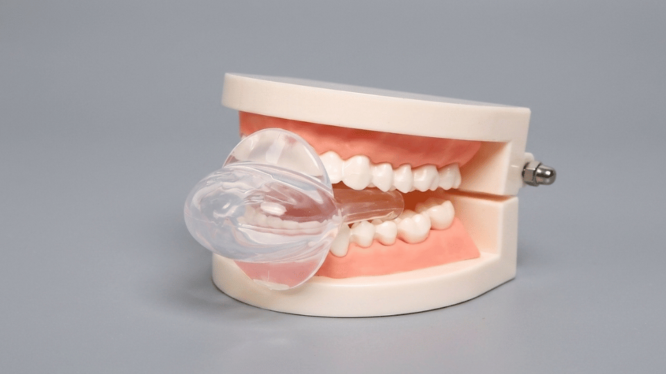 Tongue retaining device fitted on a dental model, showing how it holds the tongue forward during sleep.